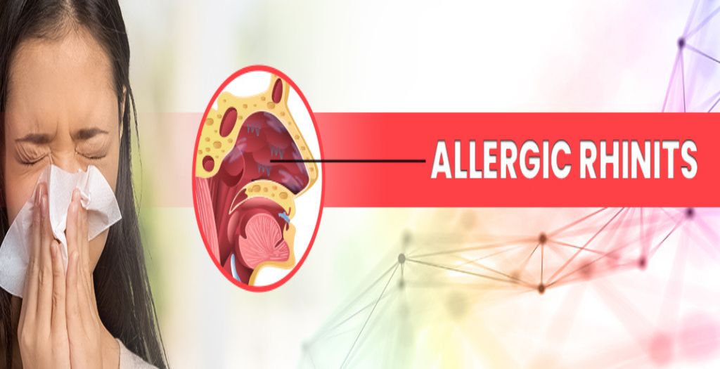 Allergic Rhinitis-blog