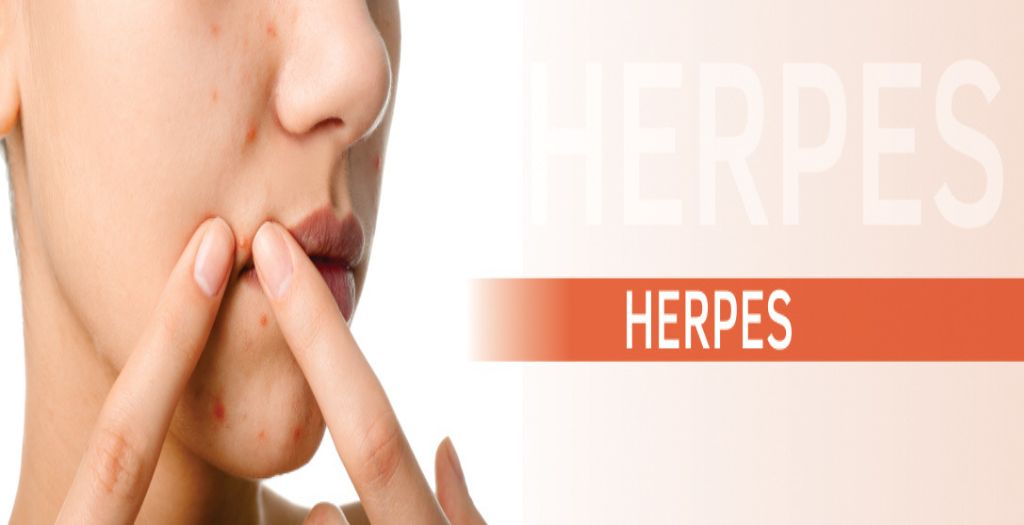 herpes-blog