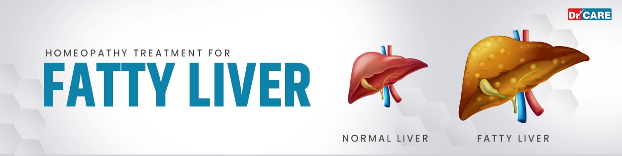 Homeopathic-Treatment-for-Fatty-liver-1920w