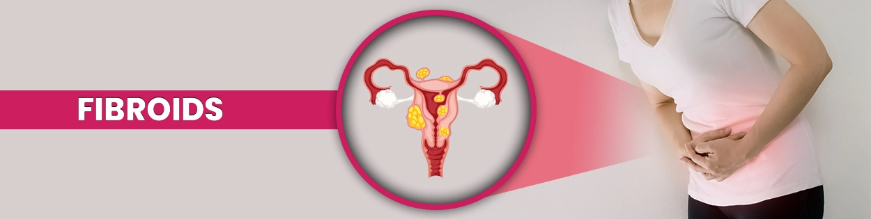 Homeopathic-Treatment-for-Fibroids